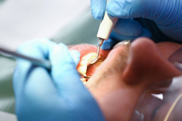 Best Emergency Gum Pain Relief  in North Bethesda, MD