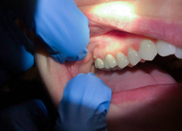Best Emergency Pediatric Dentist  in North Bethesda, MD
